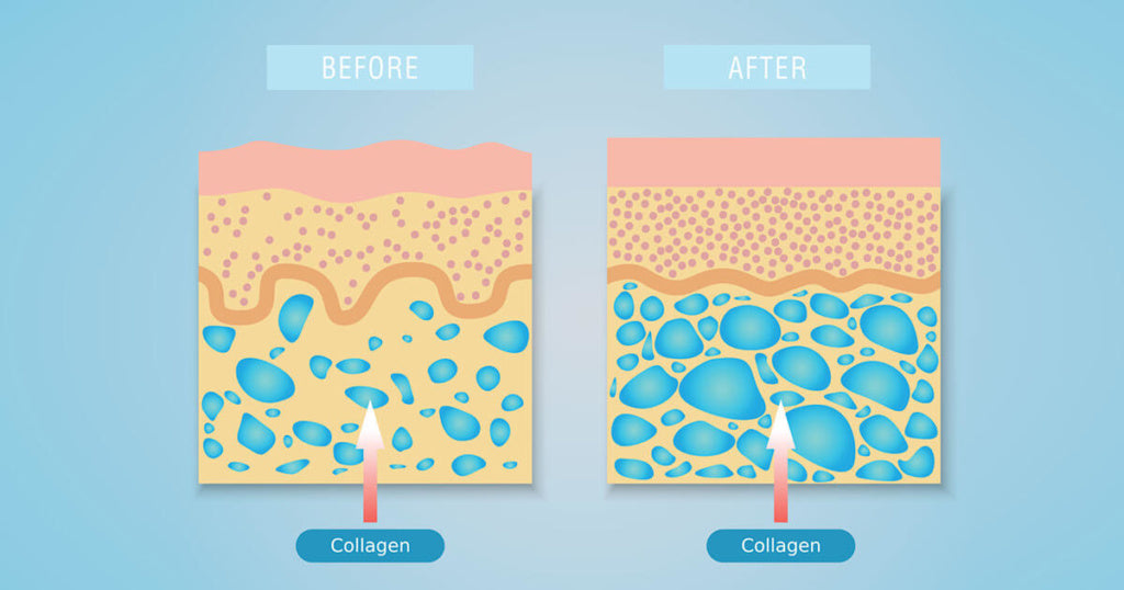 Forever Marine Collagen